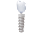 Dental Implant - Hoboken Dentist