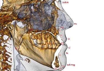 Icat imaging
