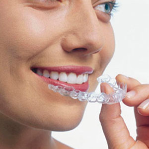 Invisalign vs. Traditional Braces - Hoboken, NJ