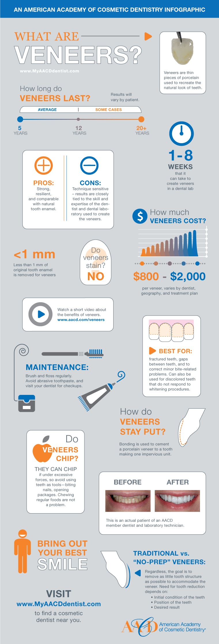 What are Dental Veneers - Infographic